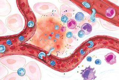 Effect van Boswellia op ontstoken delen van het lichaam