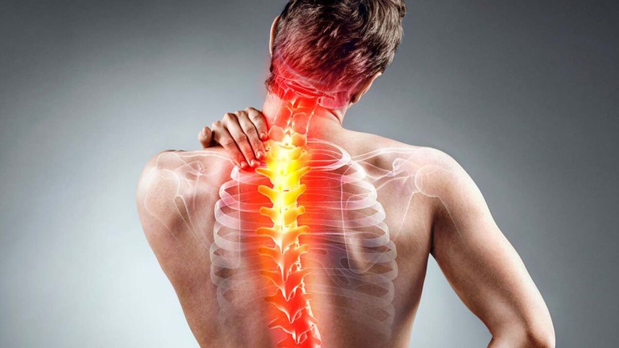 symptomen van spinale osteochondrose